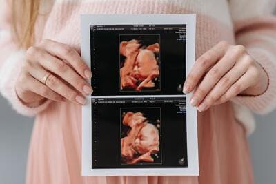 woman holding sonogram pictures