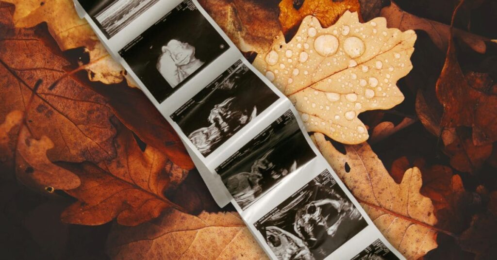 main image of Thanksgiving baby announcement quotes: sonogram pictures laying on a pile of fall leaves